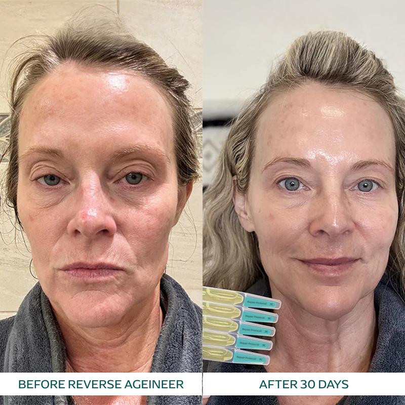 Rachel S. transformation