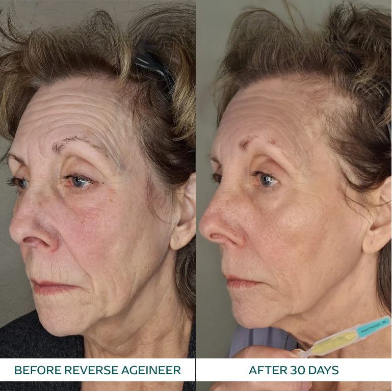 Linda P. transformation