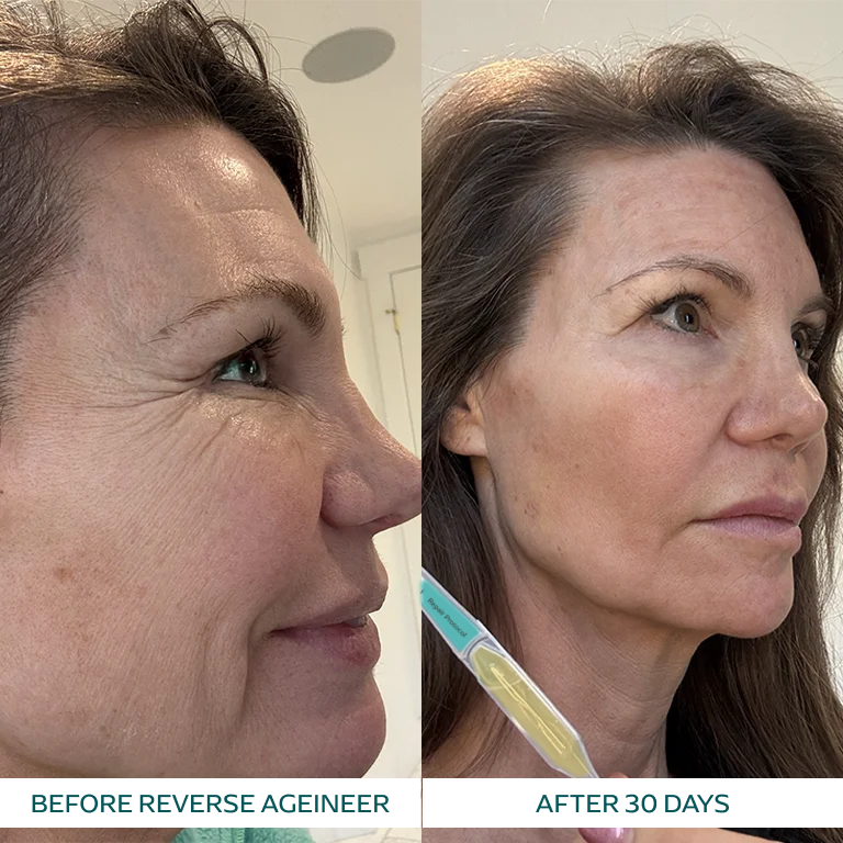 Linda P. transformation