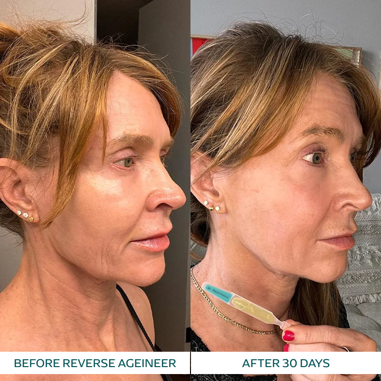 Jill S. transformation