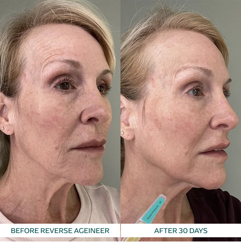 Lily K. transformation